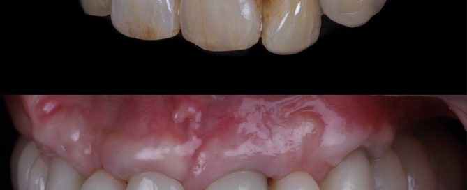 solución de enfermedad periodontal
