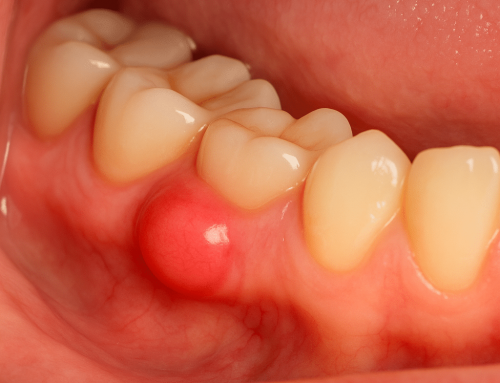 Enfermedades de las encías: causas, síntomas y tratamientos | MAG Dental Madrid