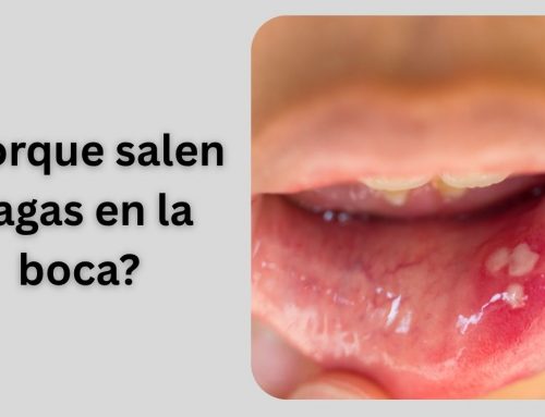 ¿porque salen llagas en la boca?