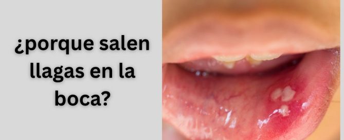 ¿porque salen llagas en la boca?
