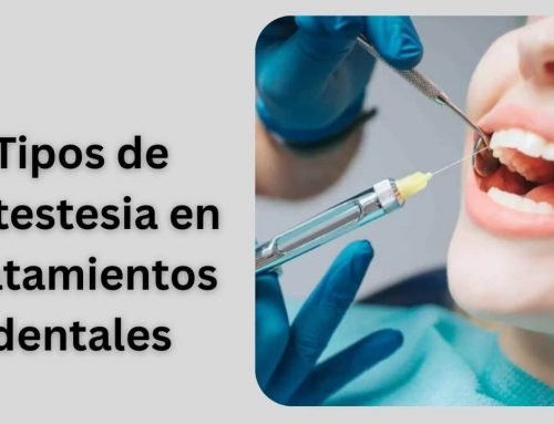 Tipos de antestesia en tratamientos dentales