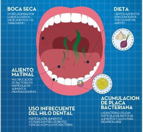 causas mal aliento