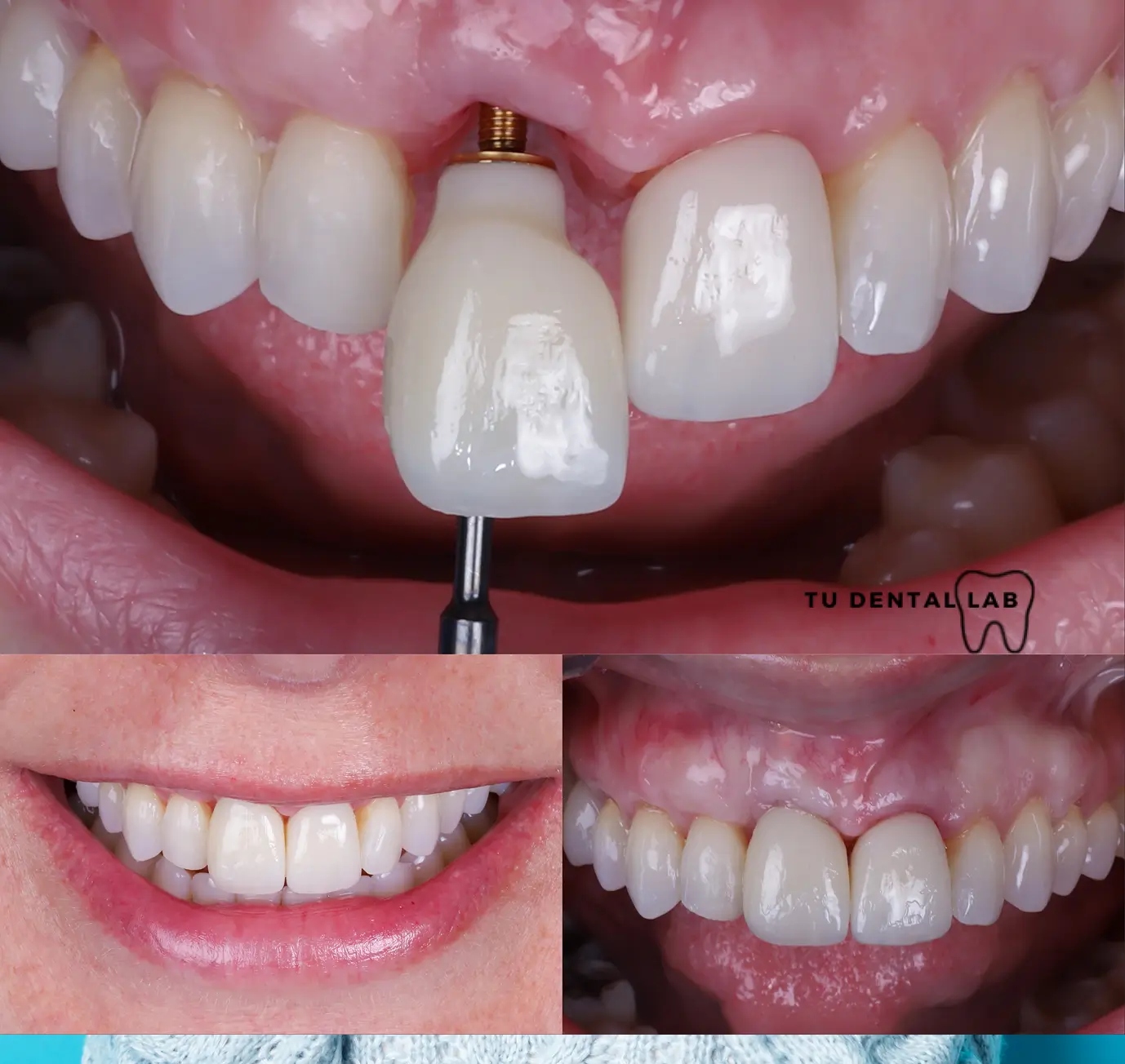 sonrisa sana dientes blancos